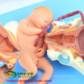 VENDER 12470 El procedimiento de entrega del parto humano consiste en un modelo de anatomía